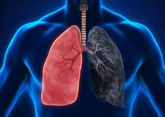 Lung Clear Pro for Respiratory Health